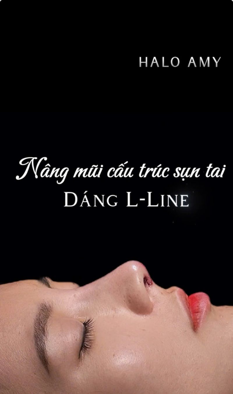 NÂNG MŨI CẤU TRÚC SỤN TAI DÁNG L-LINE