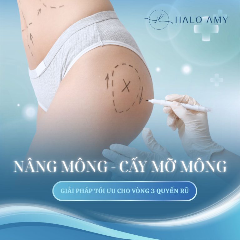 Cấy mỡ mông
