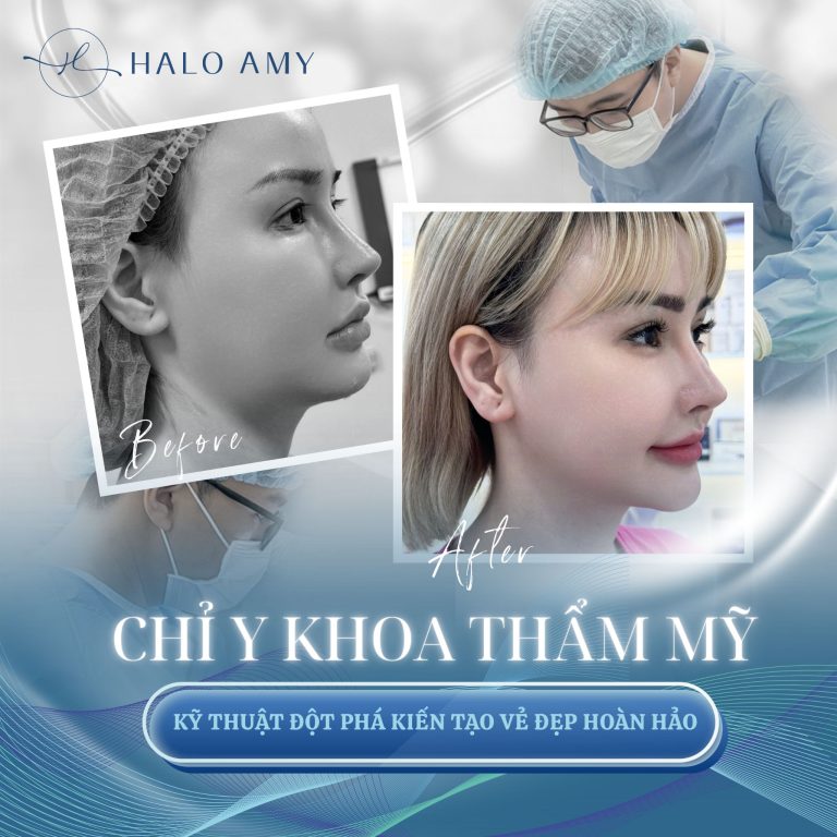 Chỉ y khoa thẩm mỹ