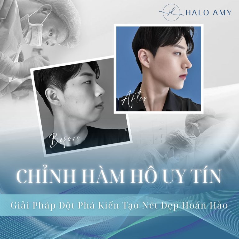Chỉnh Hàm Hô Uy Tín
